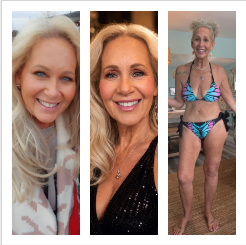 Sandee S. Gastric Sleeve Update After 4 Years*